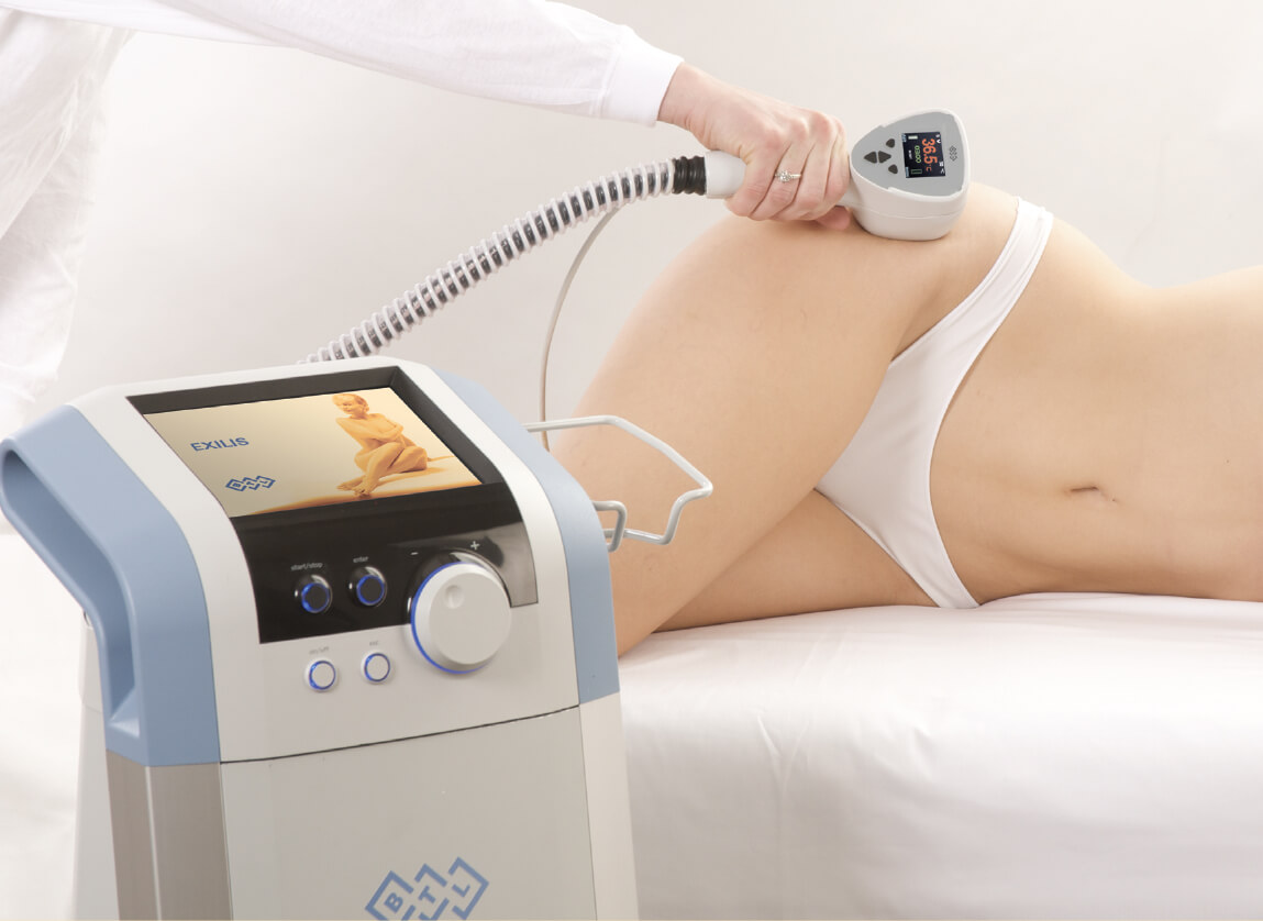 exilis-body-treatment