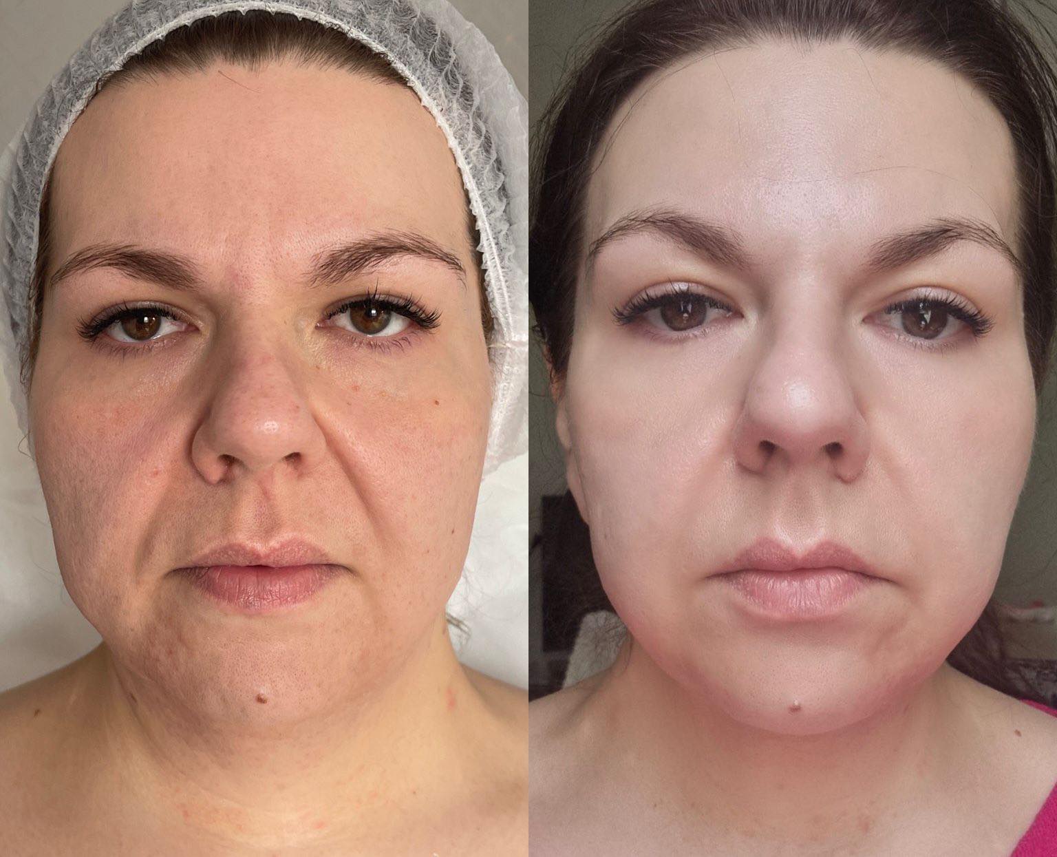 4ce0ff41-c89f-44c6-9adb-6ed5ffb24619